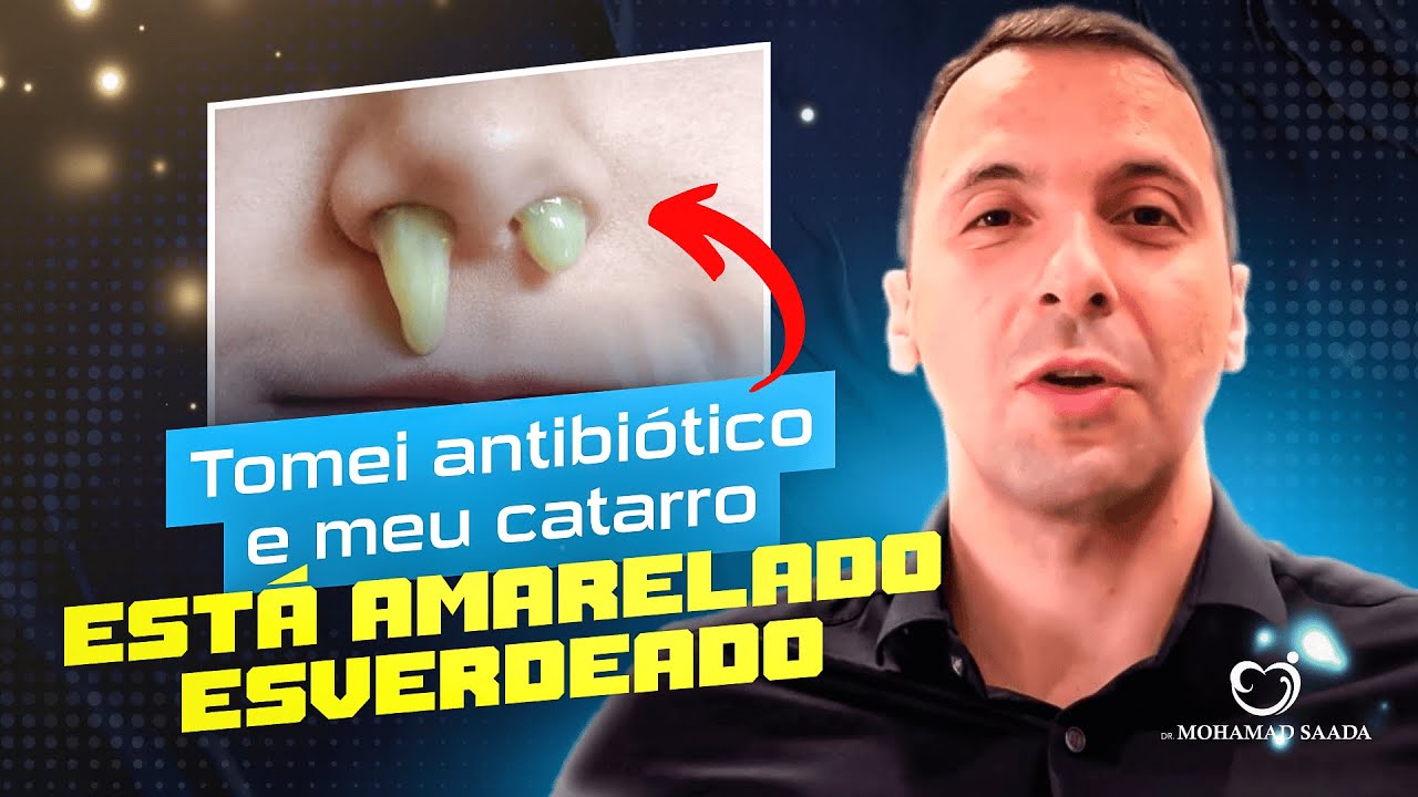 O que Significa Catarro Amarelo [ 2023 Resolvido ]