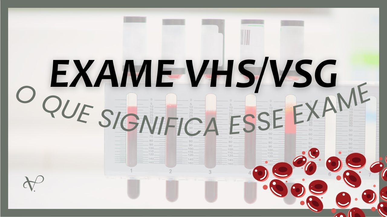 O que é Velocidade De Hemossedimentação [ 2023 Resolvido ]