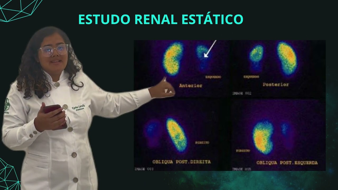 O que é Cintilografia Renal [ 2023 Resolvido ]