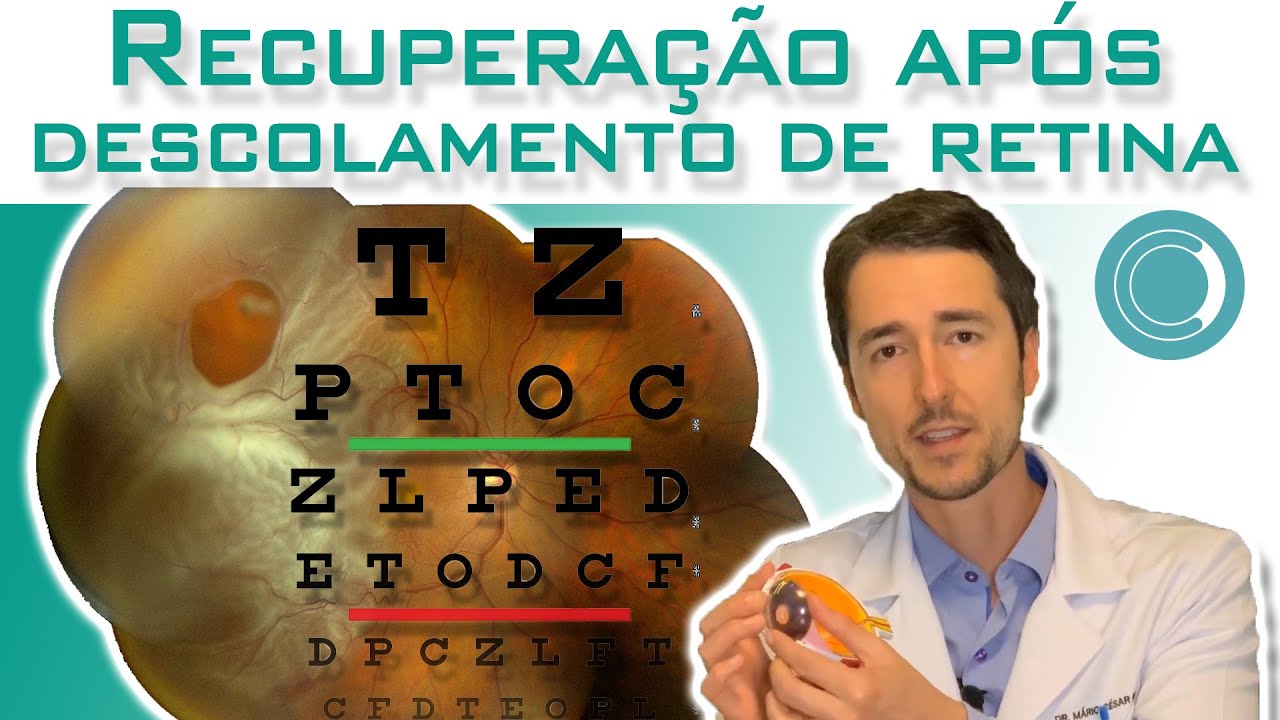 O que Causa Descolamento De Retina [ 2023 Resolvido ]