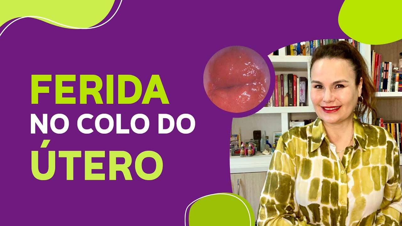 O que Causa Ferida No Utero [ 2023 Resolvido ]