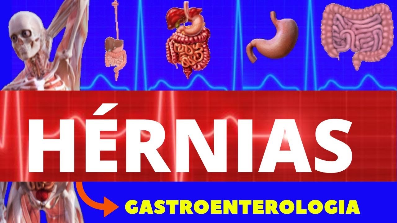 O que é Dor Epigástrica [ 2023 Resolvido ]
