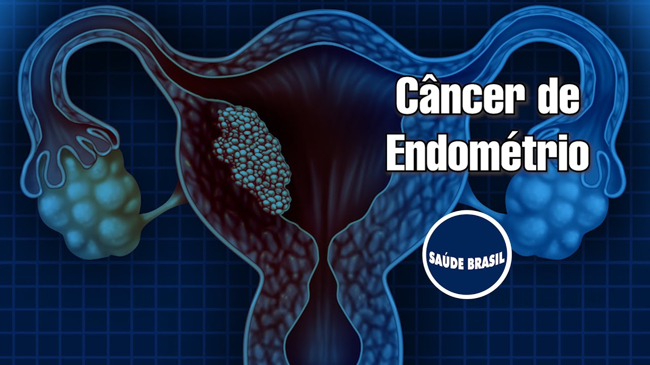 O que é Espessamento Endometrial [ 2023 Resolvido ]