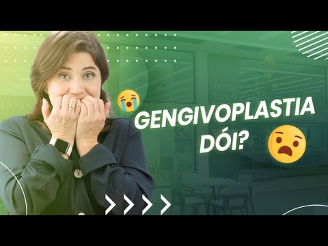 O que é Gengivoplastia [ 2023 Resolvido ]