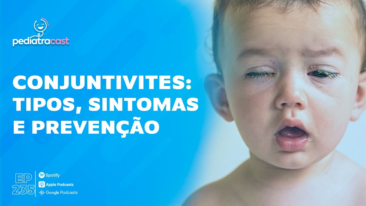 O que Não Pode Comer Quando Esta Com Conjuntivite [ 2023 Resolvido ]