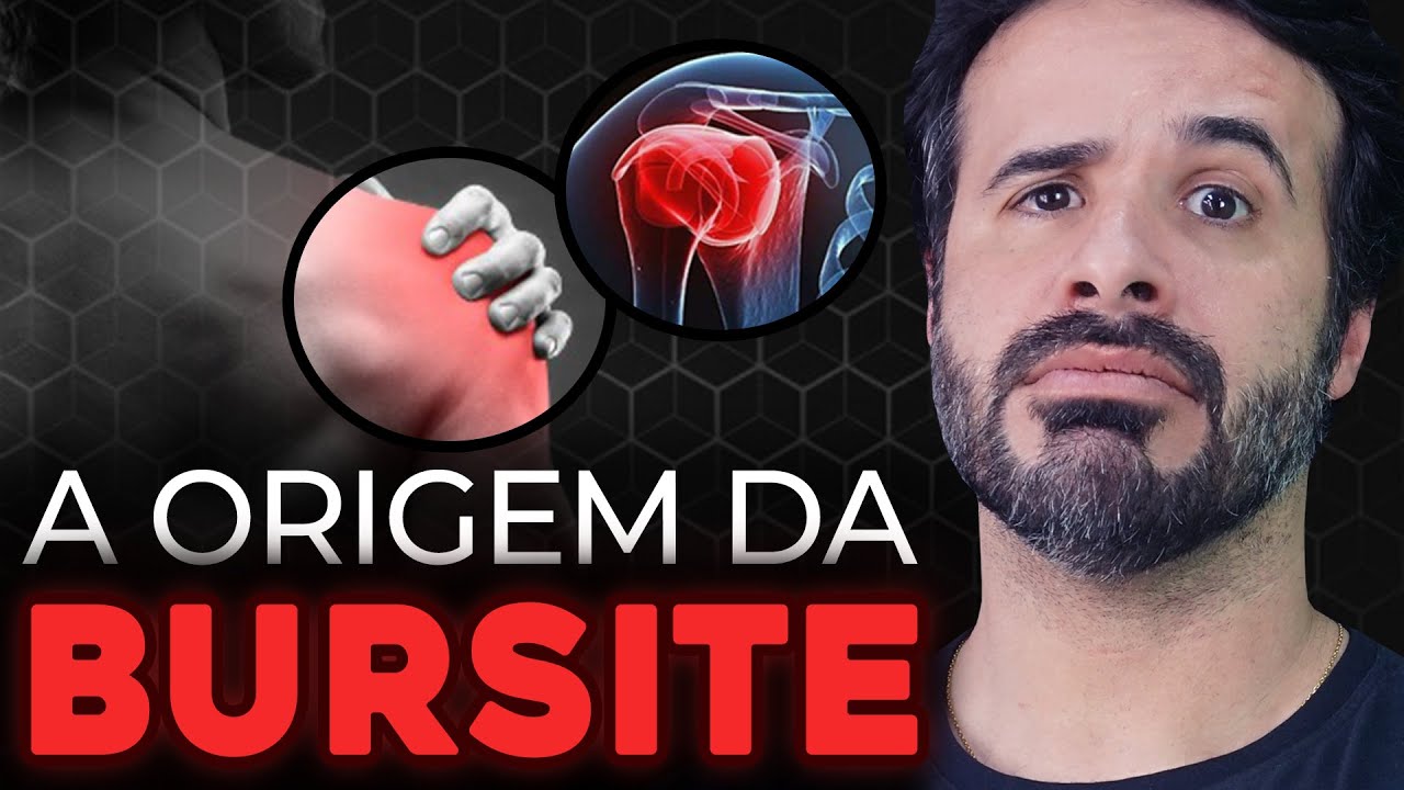 O que é Bursite No Ombro [ 2023 Resolvido ]